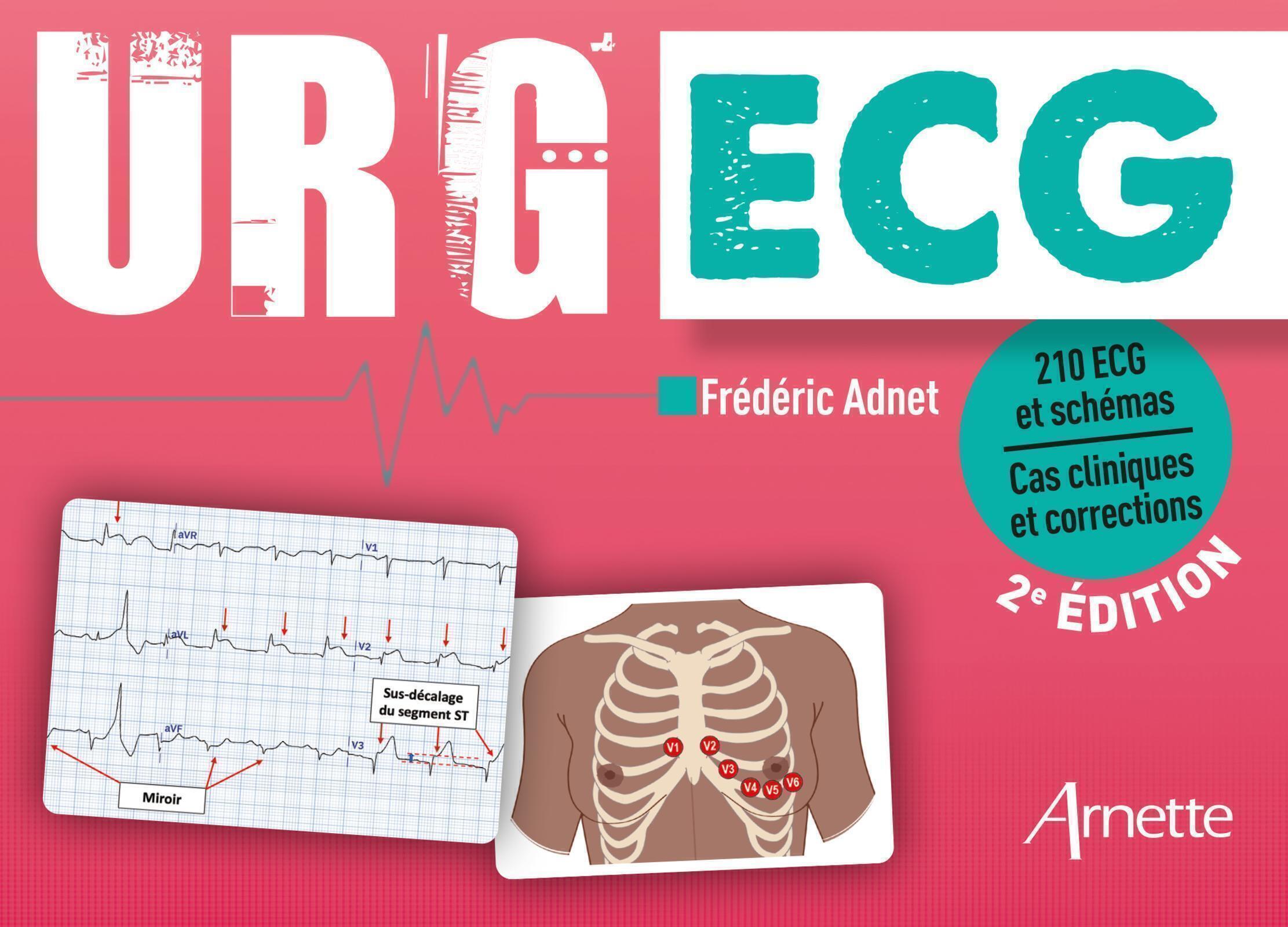 URG' ECG (2e édition) - Frédéric Adnet - ARNETTE EDITION